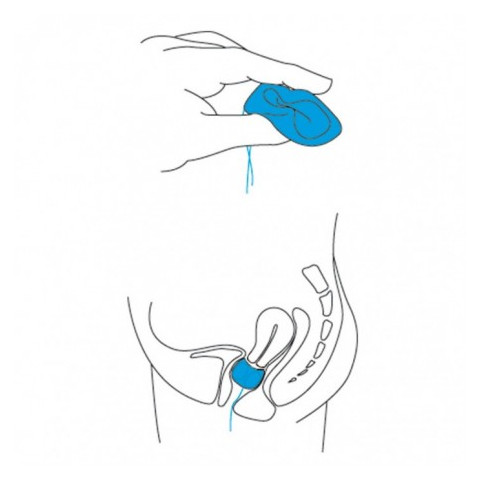 Pessaire cubique perforé Gyn&Cube - Gyneas  - 3
