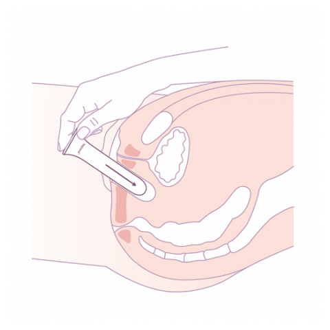 Vagiwell - Dilatateur vaginal taille 6 Vagiwell - 6